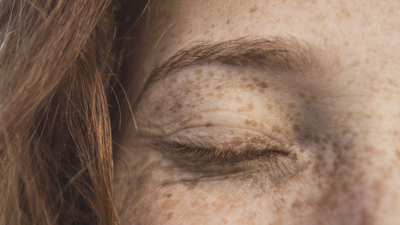 All About the BBL Photofacial: The Secret to Brighter, Youthful-Looking Skin