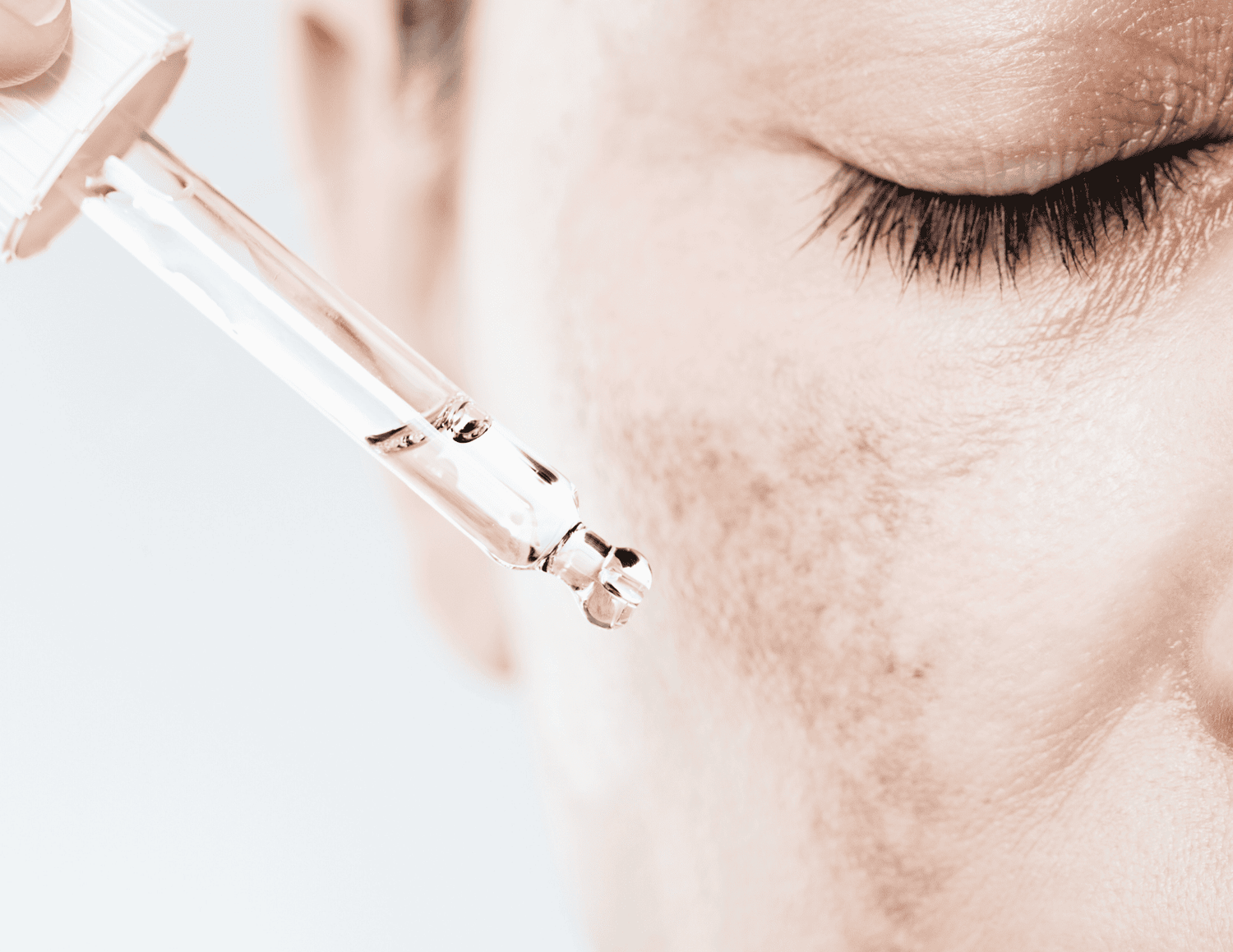 Melasma: A Comprehensive Guide