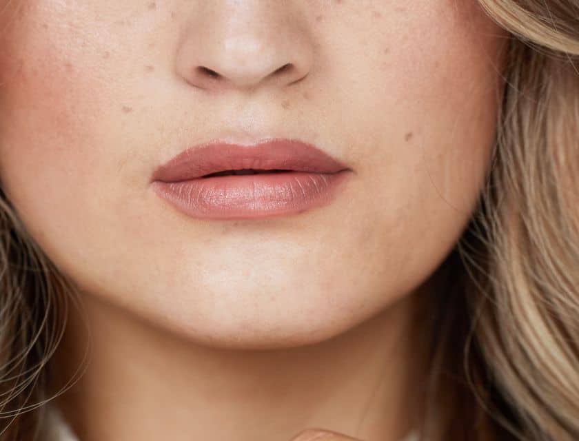 Everything You Need to Know About Glycolic Acid
