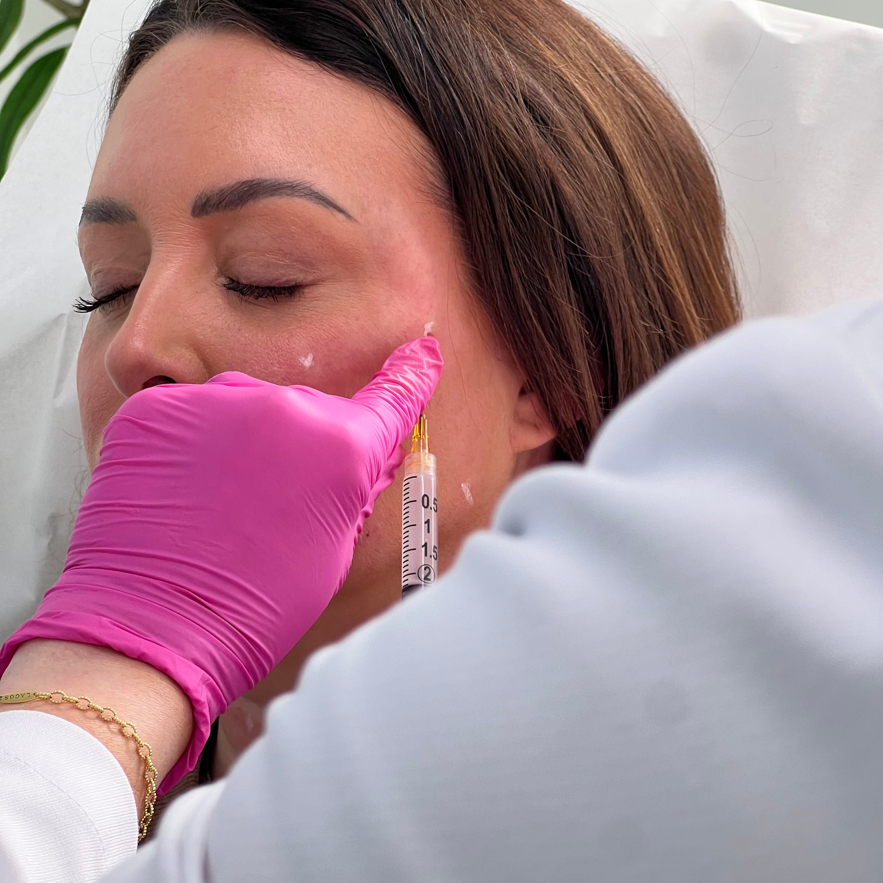 Woman receiving sculptra, a collagen-stimulating treatment with a professional in a clinical setting.